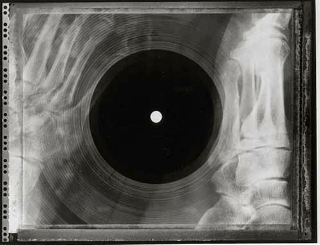 Illustration for article titled Soviet-era bootleg recordings made on discarded X-ray plates